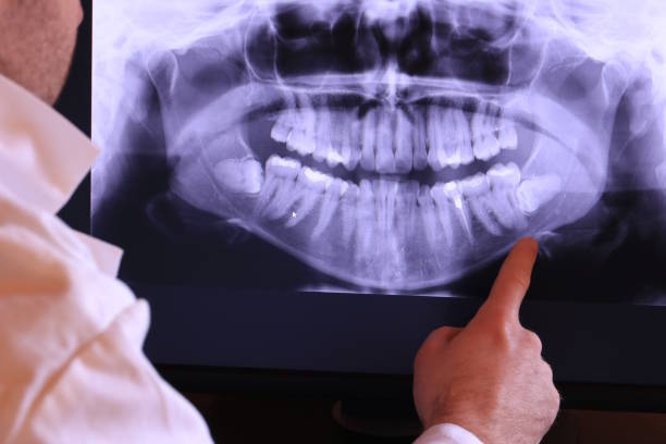 Best Emergency Dentist for Knocked-Out Tooth in Pleasantville, NY